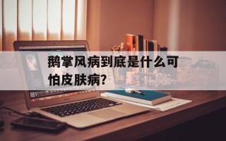 鹅掌风病到底是什么可怕皮肤病？