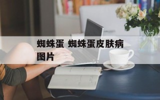 蜘蛛蛋 蜘蛛蛋皮肤病图片